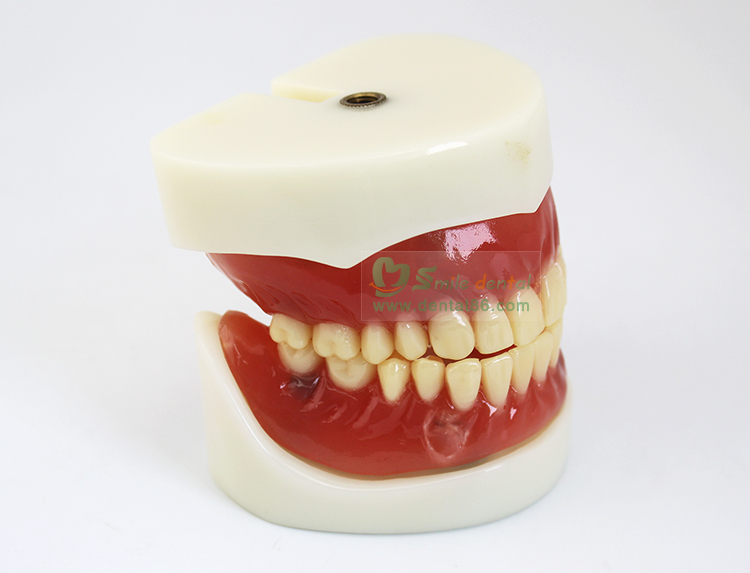 TM-T21 Full Denture Implant Mode